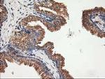 TUBB4 Antibody in Immunohistochemistry (Paraffin) (IHC (P))