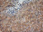 TUBB4 Antibody in Immunohistochemistry (Paraffin) (IHC (P))