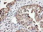 TUBB4 Antibody in Immunohistochemistry (Paraffin) (IHC (P))