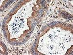 TUBB4 Antibody in Immunohistochemistry (Paraffin) (IHC (P))