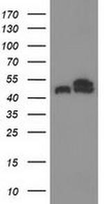 TUBB4 Antibody in Western Blot (WB)