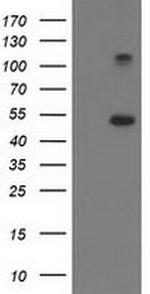 TUBB4 Antibody in Western Blot (WB)