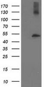 TUBB4 Antibody in Western Blot (WB)