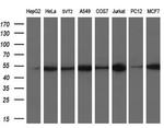 TUBB4 Antibody in Western Blot (WB)