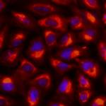 gamma Tubulin Monoclonal Antibody (4D11), Alexa Fluor™ 555