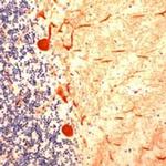 gamma Tubulin Antibody in Immunohistochemistry (IHC)