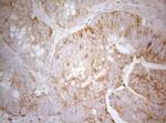 TWF1 Antibody in Immunohistochemistry (Paraffin) (IHC (P))