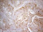 TWF1 Antibody in Immunohistochemistry (Paraffin) (IHC (P))