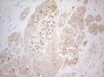 TWF1 Antibody in Immunohistochemistry (Paraffin) (IHC (P))