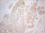 TWF1 Antibody in Immunohistochemistry (Paraffin) (IHC (P))