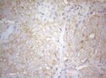 TWF1 Antibody in Immunohistochemistry (Paraffin) (IHC (P))