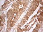TWF1 Antibody in Immunohistochemistry (Paraffin) (IHC (P))