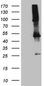 TWF1 Antibody in Western Blot (WB)