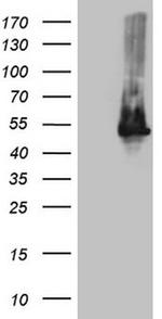 TWF1 Antibody in Western Blot (WB)