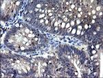 TXNDC5 Antibody in Immunohistochemistry (Paraffin) (IHC (P))