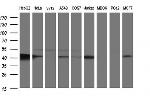 TXNDC5 Antibody in Western Blot (WB)