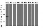 TXNDC5 Antibody in Western Blot (WB)