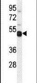TXNDC6 Antibody in Western Blot (WB)