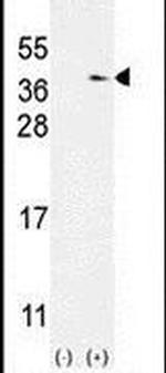 TXNDC6 Antibody in Western Blot (WB)