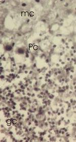 TXNL1 Antibody in Immunohistochemistry (IHC)