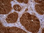 TXNRD1 Antibody in Immunohistochemistry (Paraffin) (IHC (P))