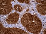 TXNRD1 Antibody in Immunohistochemistry (Paraffin) (IHC (P))