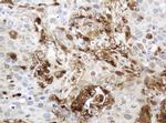 TYMP Antibody in Immunohistochemistry (Paraffin) (IHC (P))