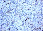 TYMP Antibody in Immunohistochemistry (Paraffin) (IHC (P))