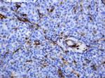 TYMP Antibody in Immunohistochemistry (Paraffin) (IHC (P))