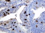 TYMP Antibody in Immunohistochemistry (Paraffin) (IHC (P))