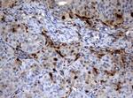 TYMP Antibody in Immunohistochemistry (Paraffin) (IHC (P))