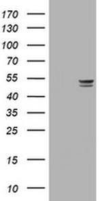 TYMP Antibody in Western Blot (WB)