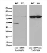 TYMP Antibody in Western Blot (WB)