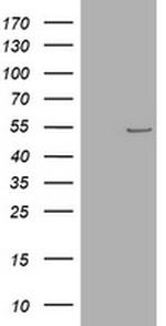 TYMP Antibody in Western Blot (WB)