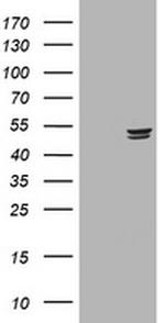 TYMP Antibody in Western Blot (WB)