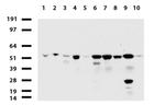 TYMP Antibody in Western Blot (WB)