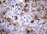 TYMS Antibody in Immunohistochemistry (Paraffin) (IHC (P))