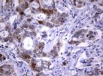 TYMS Antibody in Immunohistochemistry (Paraffin) (IHC (P))
