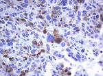 TYMS Antibody in Immunohistochemistry (Paraffin) (IHC (P))