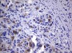TYMS Antibody in Immunohistochemistry (Paraffin) (IHC (P))