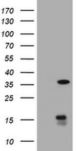TYMS Antibody in Western Blot (WB)