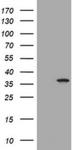TYMS Antibody in Western Blot (WB)