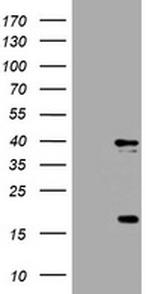 TYMS Antibody in Western Blot (WB)