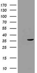 TYMS Antibody in Western Blot (WB)