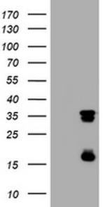 TYMS Antibody in Western Blot (WB)