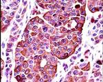 Tyrosinase Antibody in Immunohistochemistry (IHC)