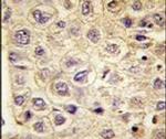 TYRO3 Antibody in Immunohistochemistry (IHC)