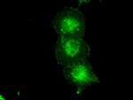 TYRO3 Antibody in Immunocytochemistry (ICC/IF)