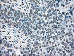 TYRO3 Antibody in Immunohistochemistry (Paraffin) (IHC (P))