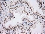 TYRO3 Antibody in Immunohistochemistry (Paraffin) (IHC (P))